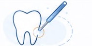 Ilustración de periodoncia e implantes dentales